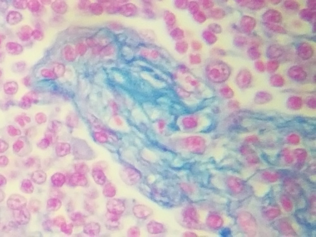 Reticular Connective Slides - Reticular Connective 13 400X